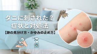 ダニに刺された症状と対処法【跡の見分け方・かゆみの止め方まで】 